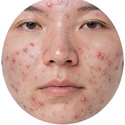 Anti-Aging